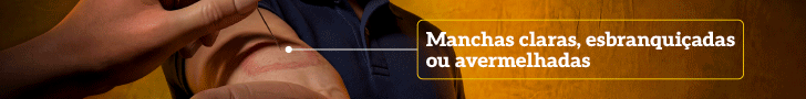 ALMT PI NÚMERO: 54722 BANNER 05